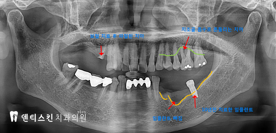 00533aaccaf8a3d19ac8b4e06d7097c1_1747997193_5161.jpg