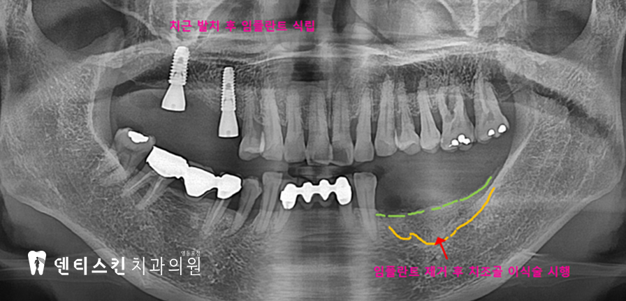 00533aaccaf8a3d19ac8b4e06d7097c1_1747997212_1878.jpg 00533aaccaf8a3d19ac8b4e06d7097c1_1747997212_1878.jpg