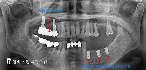 00533aaccaf8a3d19ac8b4e06d7097c1_1747997252_9404.jpg 00533aaccaf8a3d19ac8b4e06d7097c1_1747997252_9404.jpg