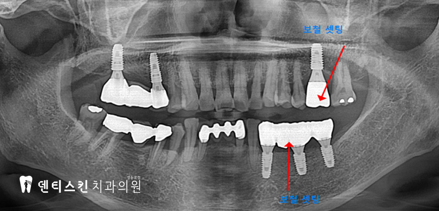 00533aaccaf8a3d19ac8b4e06d7097c1_1747997287_6519.jpg 00533aaccaf8a3d19ac8b4e06d7097c1_1747997287_6519.jpg