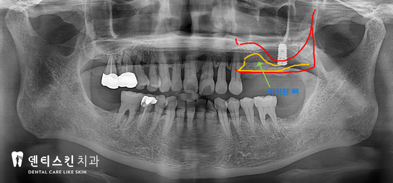00533aaccaf8a3d19ac8b4e06d7097c1_1747997534_16.jpg 00533aaccaf8a3d19ac8b4e06d7097c1_1747997534_16.jpg