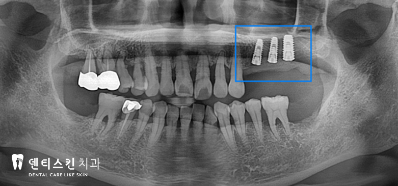 00533aaccaf8a3d19ac8b4e06d7097c1_1747997535_5768.jpg 00533aaccaf8a3d19ac8b4e06d7097c1_1747997535_5768.jpg