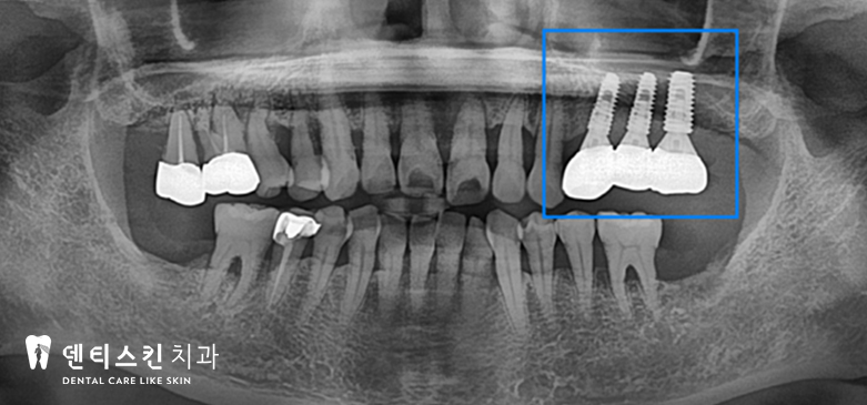 00533aaccaf8a3d19ac8b4e06d7097c1_1747997538_3728.jpg 00533aaccaf8a3d19ac8b4e06d7097c1_1747997538_3728.jpg