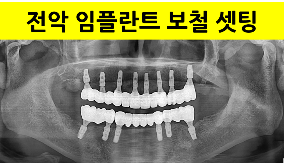 4402a16d665a1366dd52f38db914fb04_1747125462_3103.png