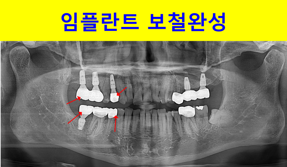 4402a16d665a1366dd52f38db914fb04_1747125654_7005.png