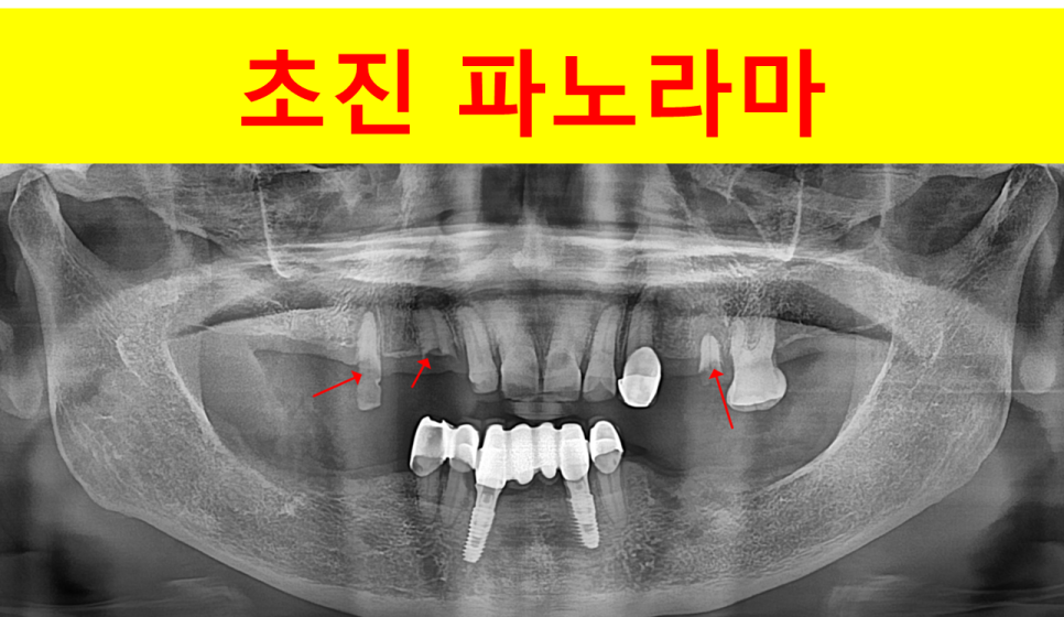 5613b175fb312bd0956c67f8c66e7be5_1747298085_8194.png 5613b175fb312bd0956c67f8c66e7be5_1747298085_8194.png