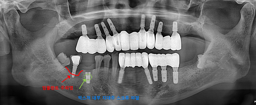 6cb9736e72e790fde737a9a8049c458c_1747906088_8649.jpg