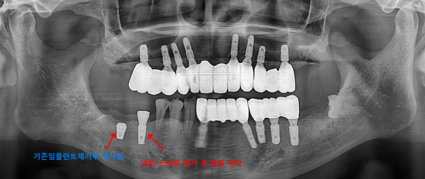6cb9736e72e790fde737a9a8049c458c_1747906138_9044.jpg