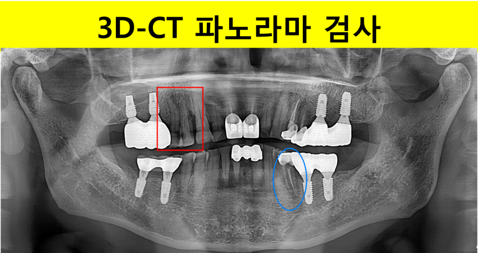 721eb3ff4cfd295e553c71302cc8de68_1747645083_675.png 721eb3ff4cfd295e553c71302cc8de68_1747645083_675.png