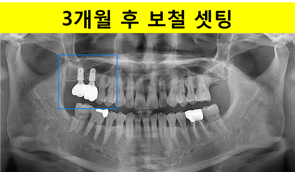 aa2ed390accdf575652cc978832a6640_1747379892_1616.png aa2ed390accdf575652cc978832a6640_1747379892_1616.png