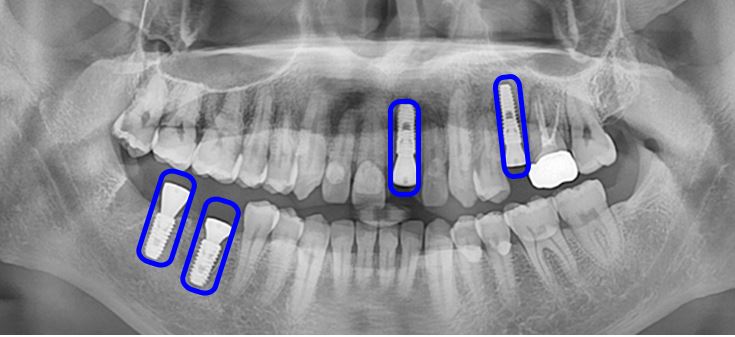 02e3aa55ccdc3d7776ceb47dc127a7ba_1750050706_8541.JPG