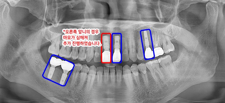 02e3aa55ccdc3d7776ceb47dc127a7ba_1750050734_3303.JPG