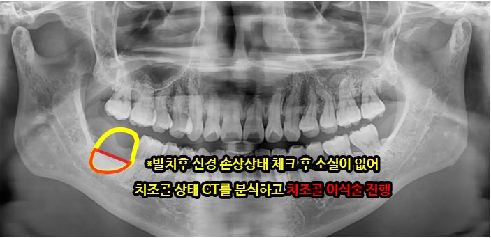 02e3aa55ccdc3d7776ceb47dc127a7ba_1750051351_3494.JPG