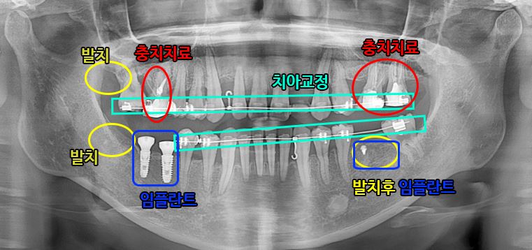 b142ab9c890f2f5068cca90244628d46_1750219149_7784.JPG