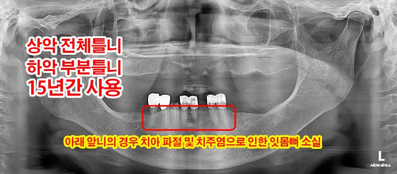 b142ab9c890f2f5068cca90244628d46_1750223589_7691.JPG