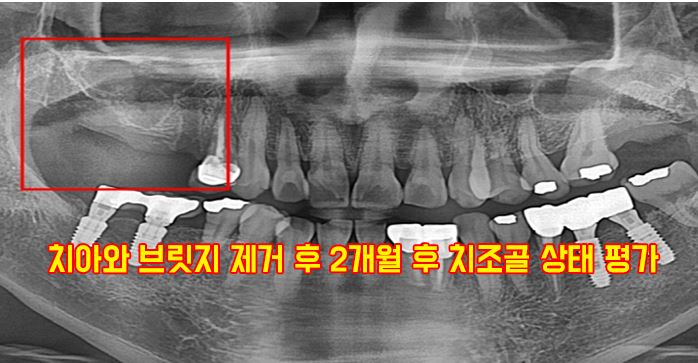 b142ab9c890f2f5068cca90244628d46_1750224261_6201.JPG