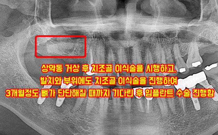 b142ab9c890f2f5068cca90244628d46_1750224318_0622.JPG