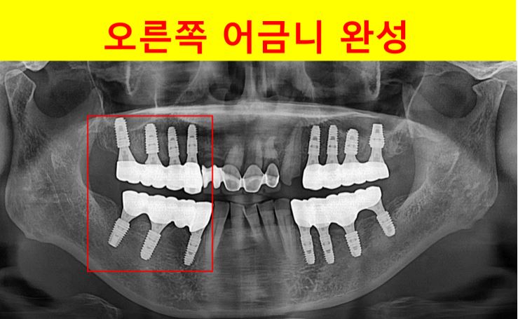 c53ea41fea21f49c7544a3c555e2bc20_1750314152_7222.JPG