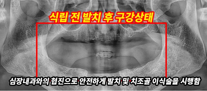 ca585682359b9eeaadc631b848033fc3_1750138819_5505.JPG