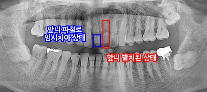 ca585682359b9eeaadc631b848033fc3_1750140052_822.JPG