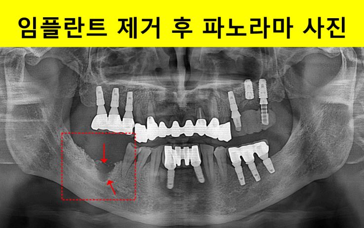 38d98fe9c5ac1594fad098d774cb9709_1753695632_9917.JPG