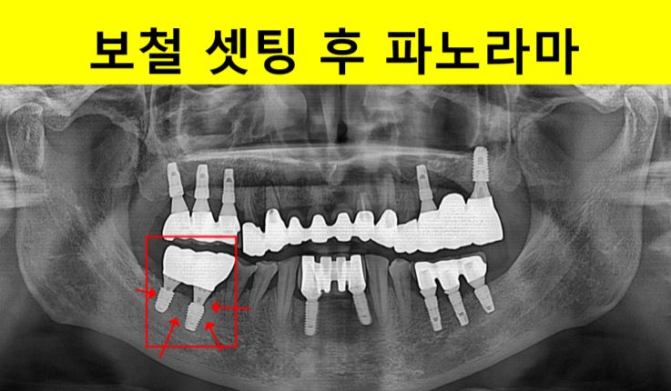 38d98fe9c5ac1594fad098d774cb9709_1753695717_3692.JPG