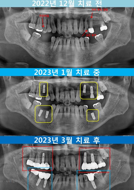 a67fb085935a206ad00158887e5cff36_1753076864_8905.JPG