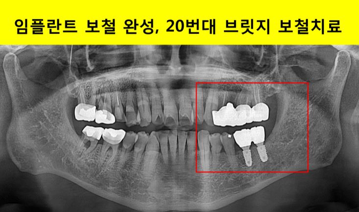 b92e53bbf83ad63eec5a34bfb82649a3_1753335385_9411.JPG